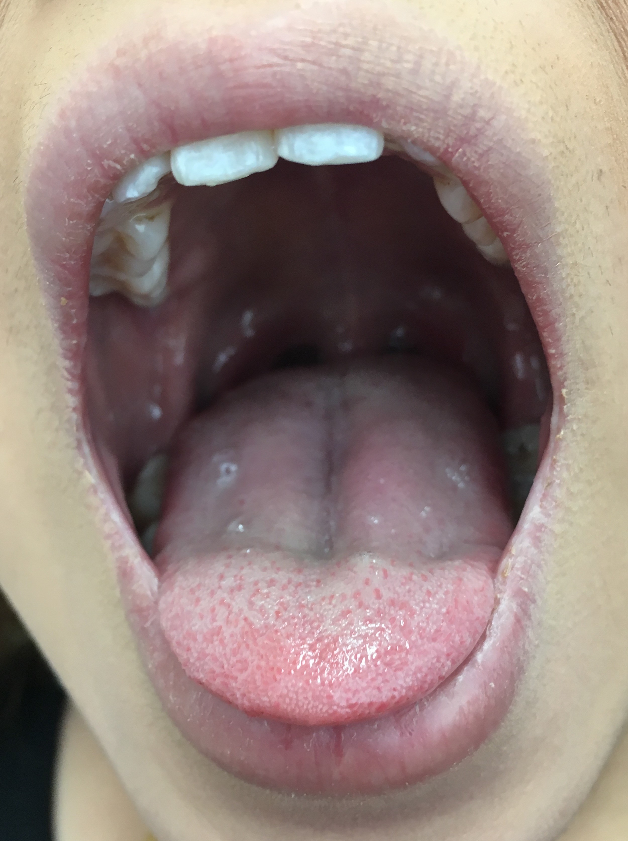 Deep throat contest /amateur pics/