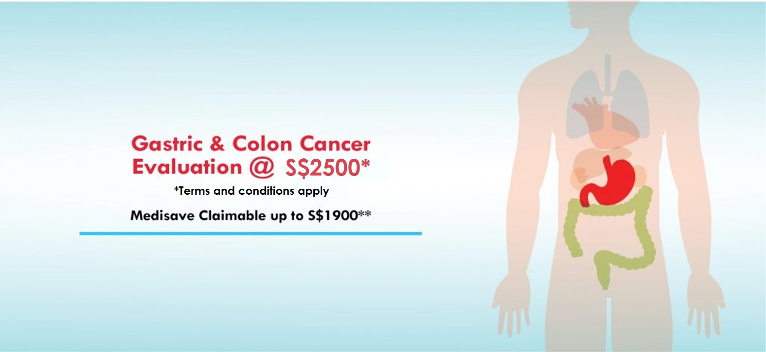 Gastric and Colon Cancer Evaluation at $1,600